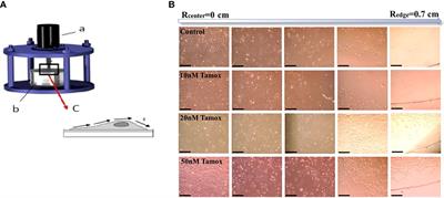 Adhesion strength and anti-tumor agents regulate vinculin of breast cancer cells